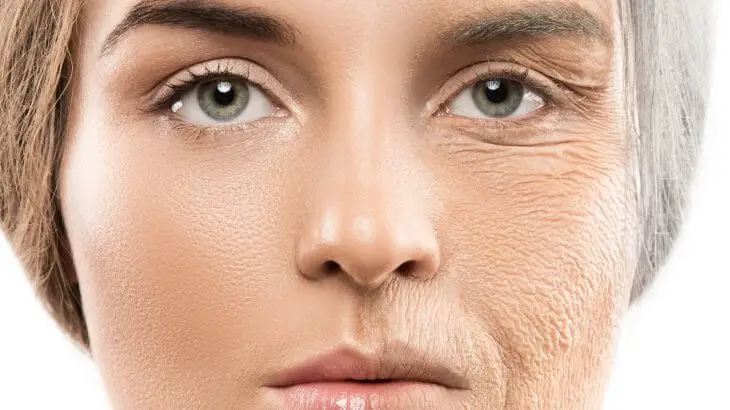 mujer con rostro con envejecimiento prematuro